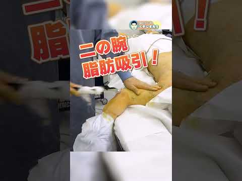 【脂肪吸引 二の腕痩せ 脚痩せ】腕も脚も同時にスッキリ！ #shorts