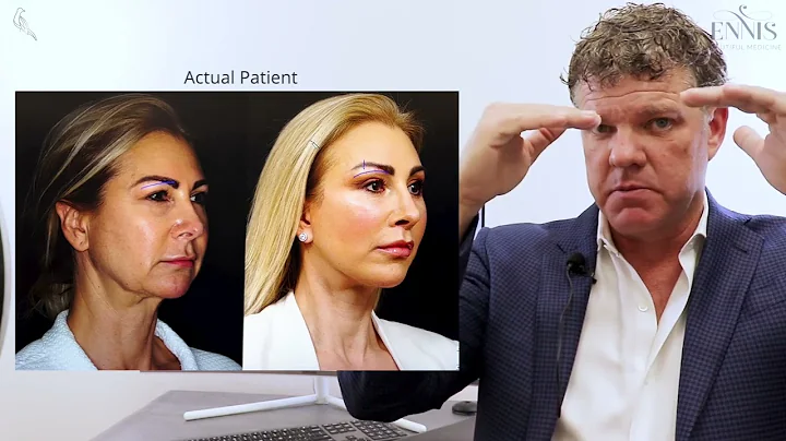 Upper Blepharoplasty vs Brow Lift. What is the Difference?