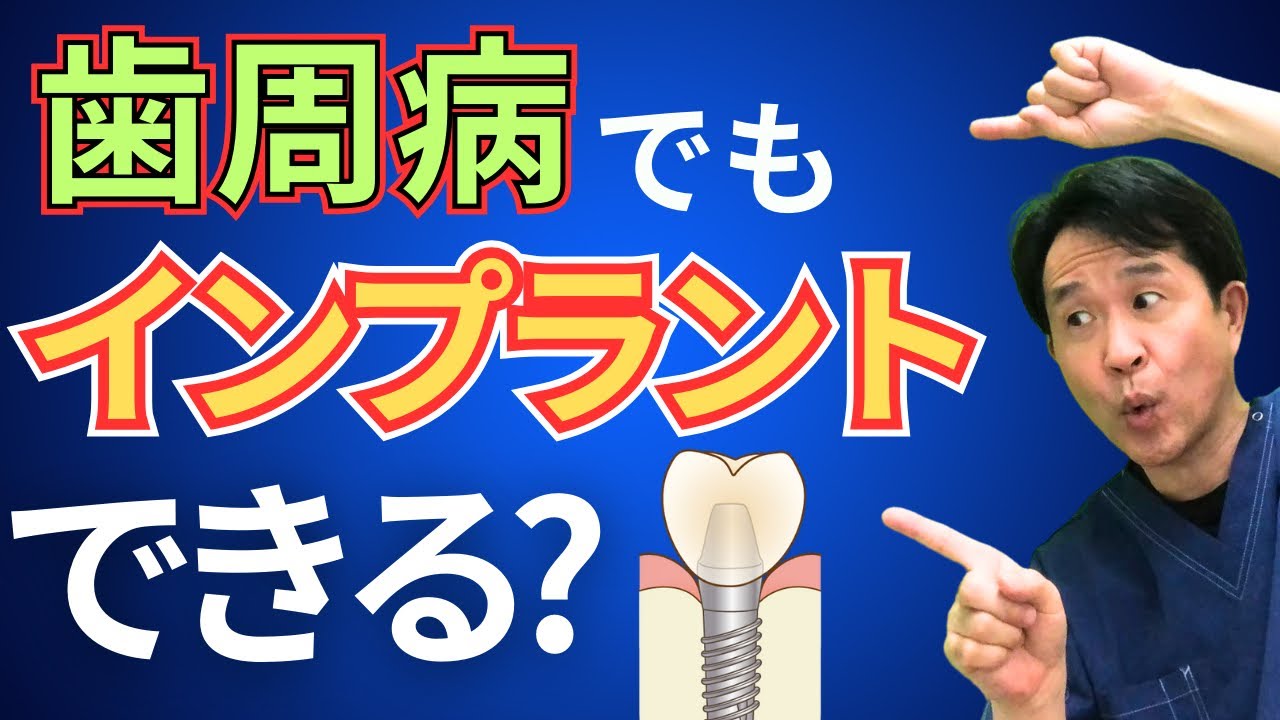 歯周病だけどインプラントしても大丈夫ですか？