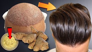 Ginger For Extreme Hair Growth, Stop Hair Loss / How To Grow Thicken And Long Hair With Ginger 2023!