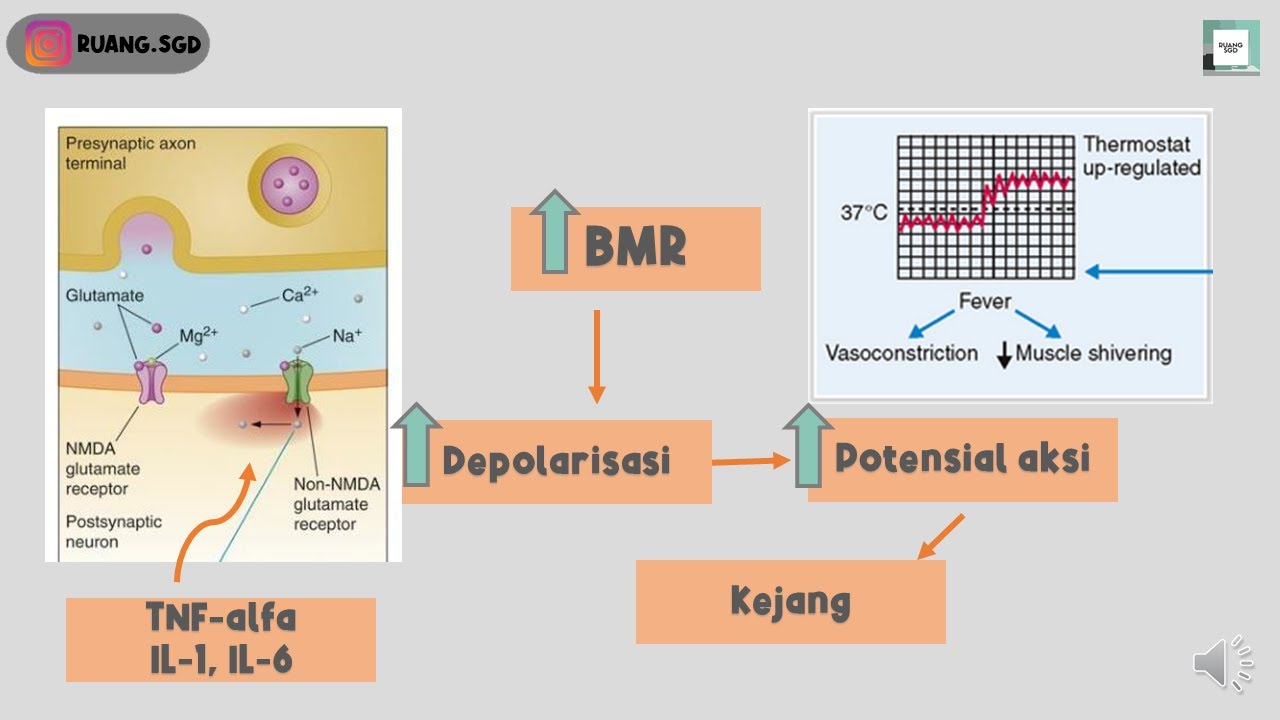 KEJANG DEMAM PADA ANAK - STASE ANAK #1