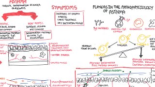 Asthma  signs and symptoms, pathophysiology