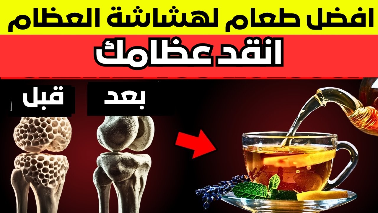 هشاشة العظام :  5 اطغمة خطيرة تدمر عضامك _ كوب واحد  فقط يوميًا لعظام قوية ومفاصل صحية وتسكين الألم