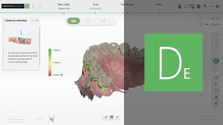 Software functions during the scanning process | Zirkonzahn.Instructions