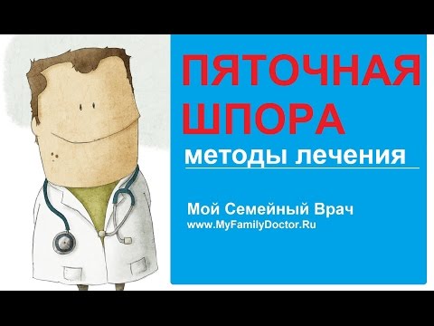 Пяточная шпора: современные методы лечения