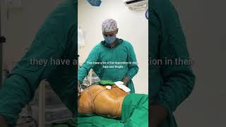HD Liposuction in Pune | 9834655013