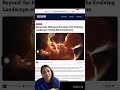 How Pregnancy May Trigger Autoimmune Disease | Fetal Microchimerism