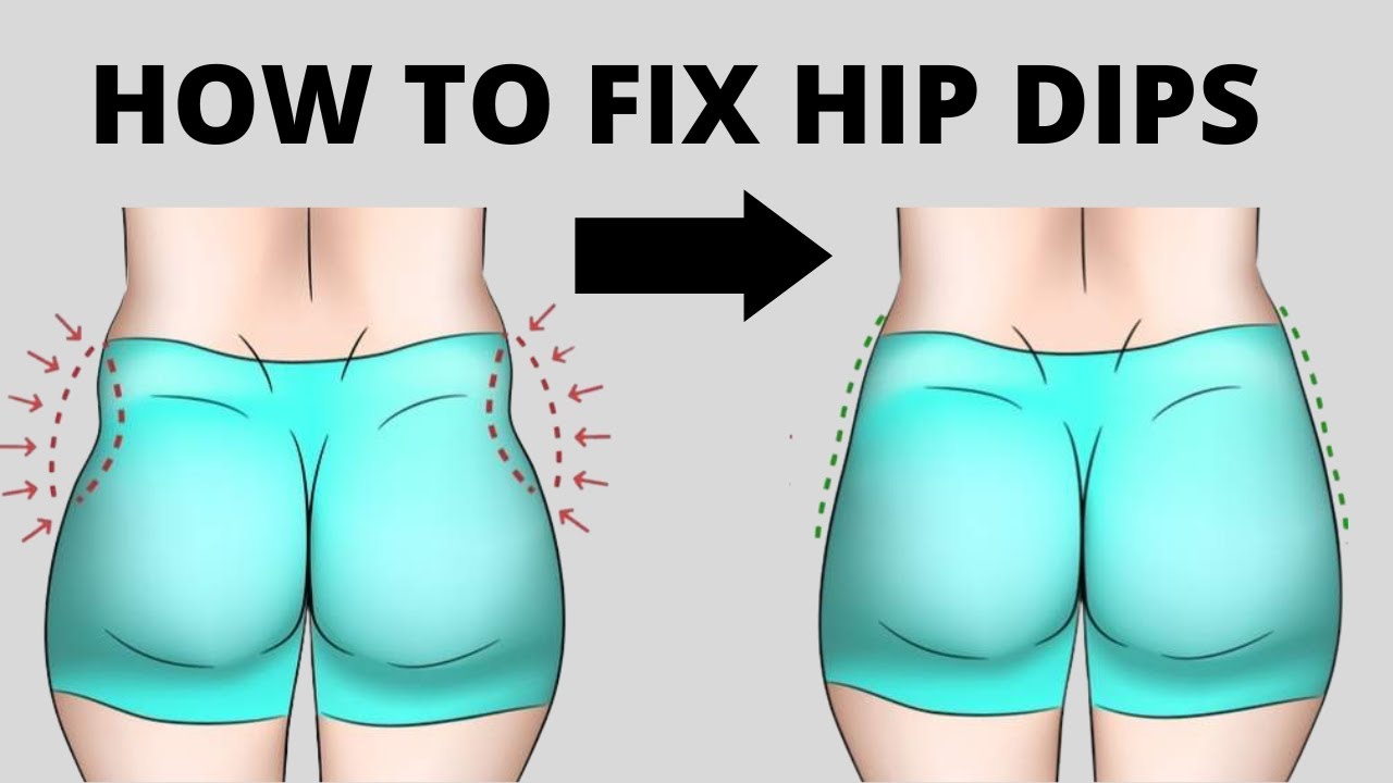 From Dips to Hips! Q&A with Dr Rosh on Hip Dip Filler 