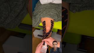 knee #foot #physiotherapist #sportsinjurytreatment #massage #painrehabb #sports #new #kinesiotaping