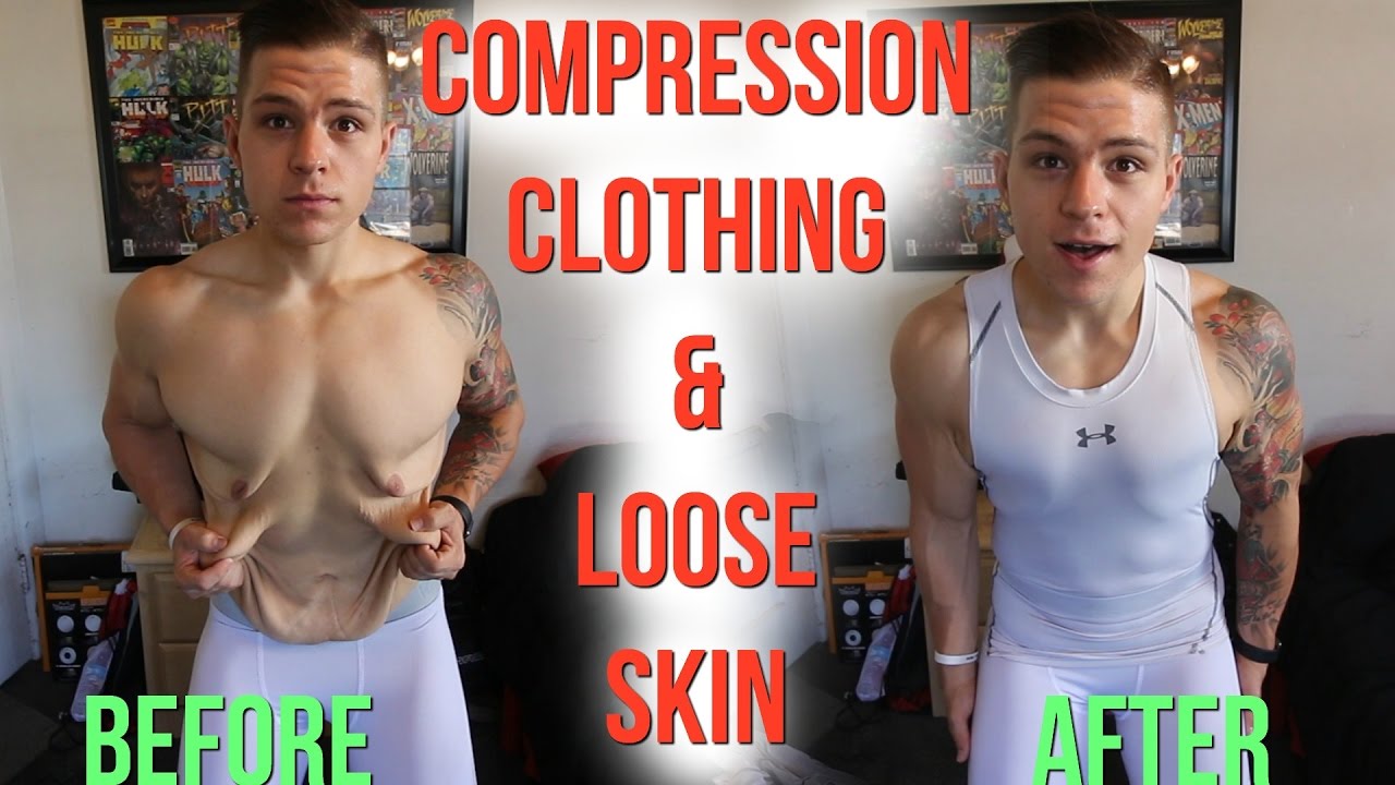 My Experience with Loose Skin & Compression Clothing 