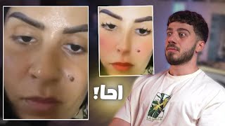 راح الفلتر و ظهر الحق