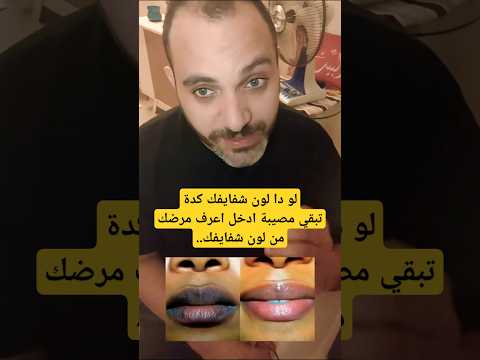 لو ماتعرفش تعالي اقولك ج1 ح3