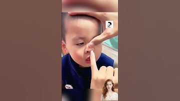 Cậu bé mắt vật thể lạ trong mũi 😨 #shortvideo #shorts