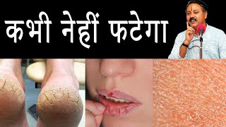 कभी नेहीं फटेंगे होंठ, एड़ियां और त्वचा || Winter Skin Care in Hindi || Rajiv Dixit Ji
