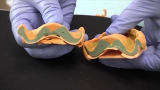 DENTCA Impressions Step 4 - Interocclusal Records