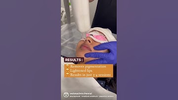 DARK LIPS BEST TREATMENT