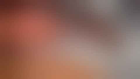 Robotic Gastric Wedge Resection of Gastric Lipoma (Transgastric)