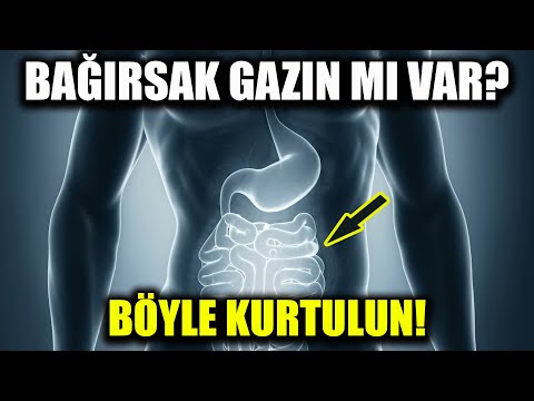 Video: Gaz Ağrılarından Nasıl Kurtulursunuz: 11 Adım (Resimlerle)