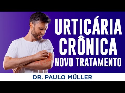 Urticária Que Não Melhora, Novo Tratamento - Dr. Paulo Müller Dermatologista.