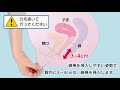 自宅で性病検査【膣分泌物の採取方法：トリコモナス・カンジダ・HPV】ＧＭＥ