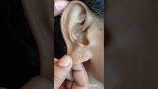 Ear Lobe Repair Treatment &amp; pricing #everyone #piercing #thenitumakeover #thenitumakeover #shorts