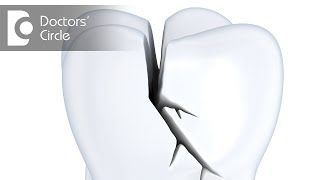 Restoration of Endodontic ally treated teeth