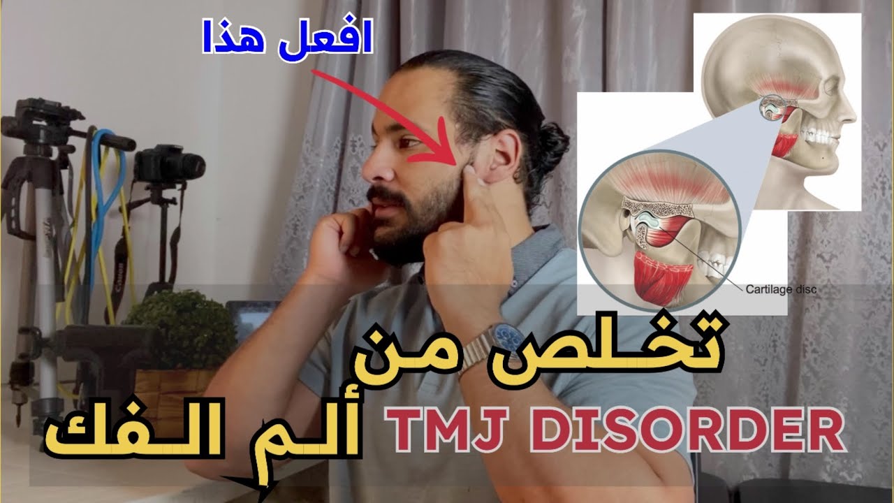 ألم مفصل الفك | شرح تفصيلي لألم الفك واعراضه والادوية المستعملة والتخلص من ألمه تماماً |TMJ Disorder