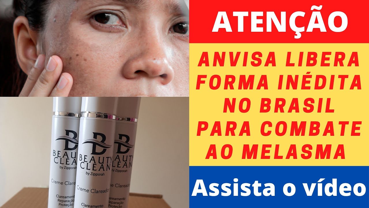 beauty clean clareador👉beauty clean funciona? Saiba Como Acabar com os Melasmas e Manchas na Pele.