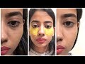 How i got Rid of my Dark Circles In 7 Days