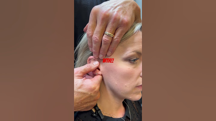Epic Ear Adjustment! #chiropractic #asmr #chiropractor #adjustment #trending