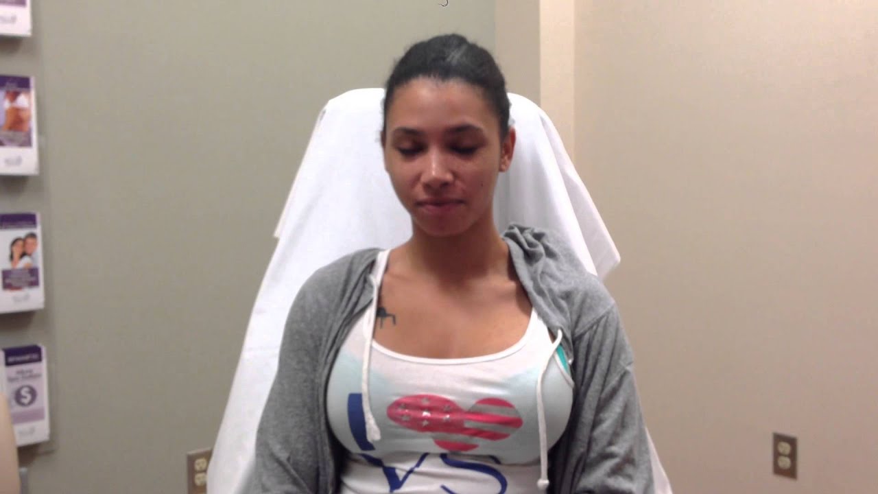 breast augmentation subglandular vs submuscular breast augmentation subglandular vs submuscular