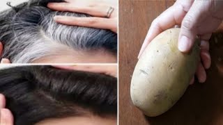 White Hair Dye Naturally With Potato | White Hair To Black Hair in 3 minutes | Gray hair dye