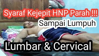 TERAPI PIJAT URUT SYARAF KEJEPIT HNP LUMBAR CERVICAL | PASIEN LUMPUH | TERAPI #5