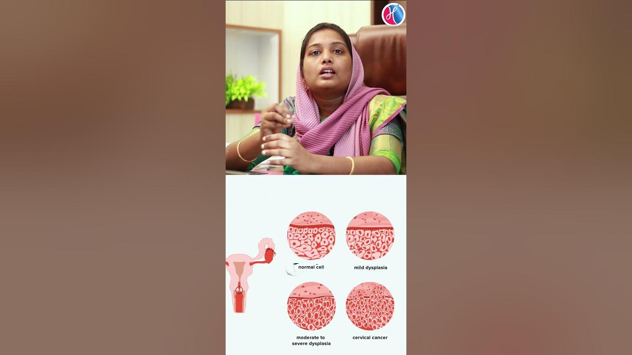 pap-smear-test-cervical-cancer-screening-in-tamil-dr-ashika-m-s-og