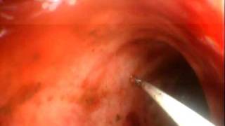 Видео Колоноскопия пекинеса,гистиоцитарный колит www.endovet.su (автор: Alexandr Chernov)