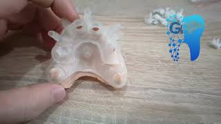 Stackable surgical guide