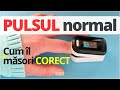 Care E PULSUL NORMAL Valorile Recomandate De Medici 