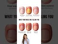 Your Nails Can Show Hidden Health Issues