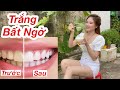 Tẩy Trắng Răng Siêu Nhanh Tại Nhà - Răng Trắng Bất Ngờ Sau 1 Lần Sài Thứ Này