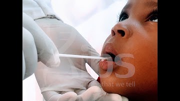 How To Collect Mouth Swabs for DNA Testing