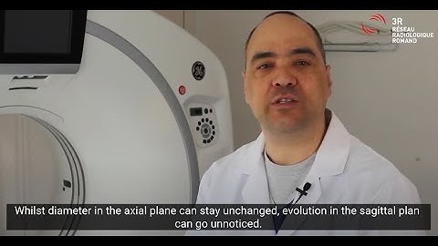 Veye Lung Nodules  @3R Group