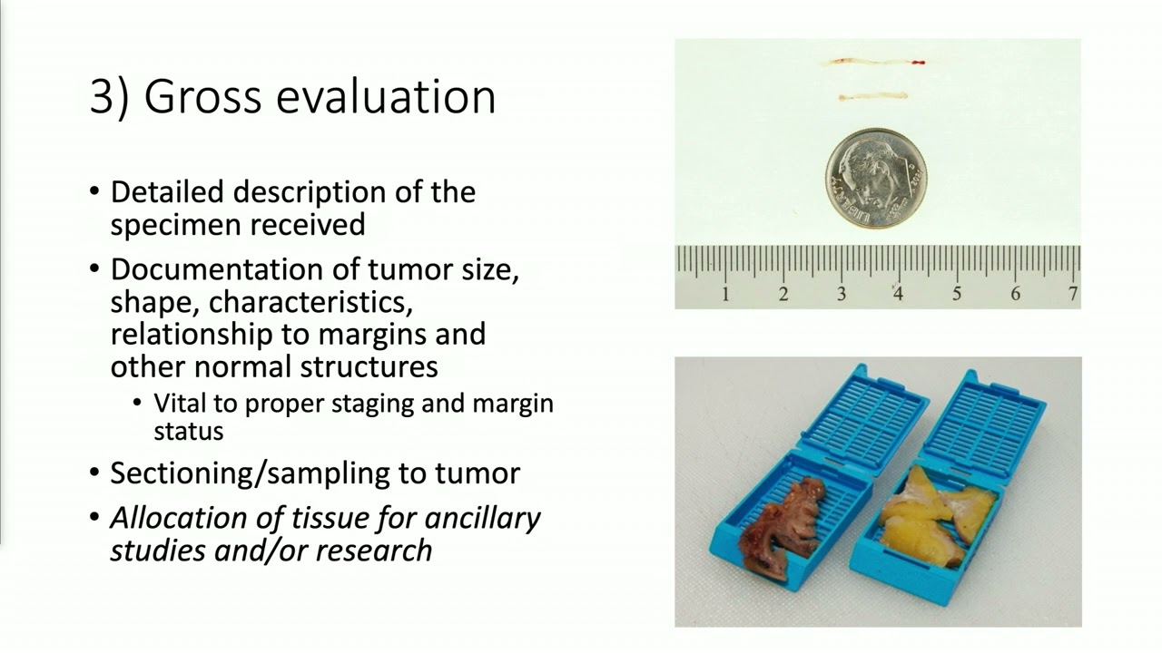 Panel: Liquid Biopsies and Biomarkers