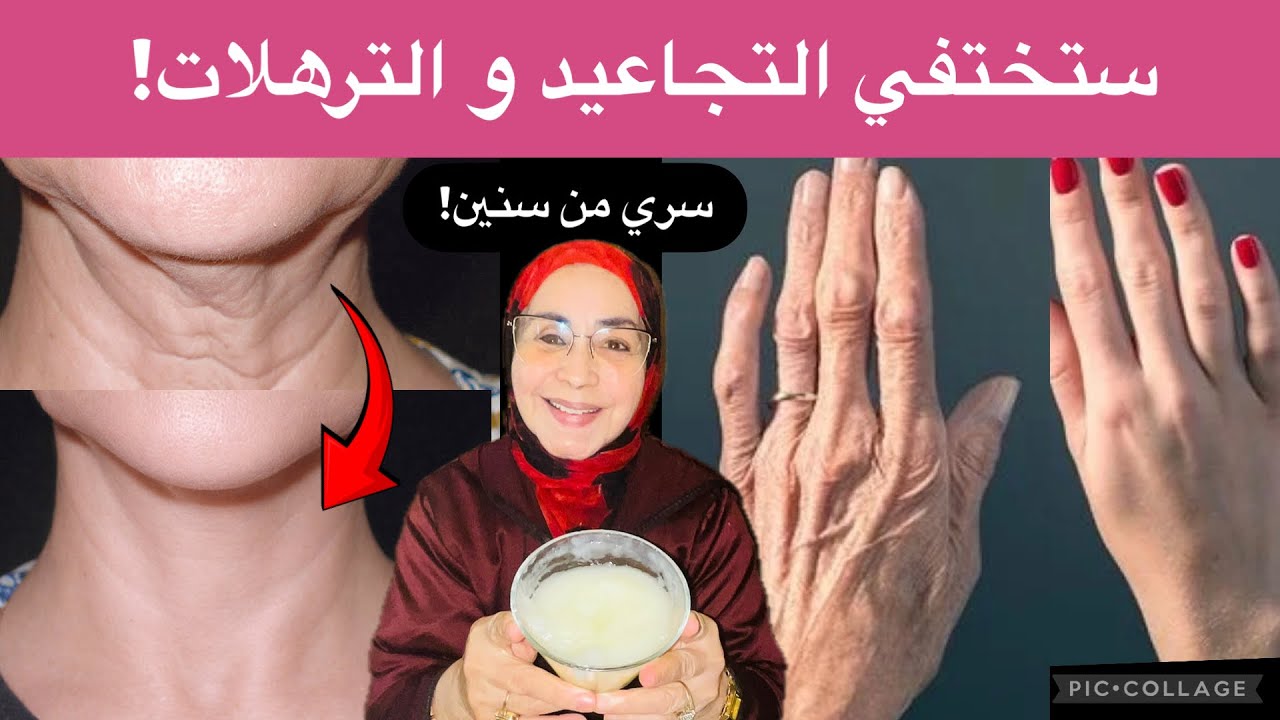 أنا فوق الـ70… وهذا سرّ اختفاء ترهلات الرقبة وتجاعيد اليدين!