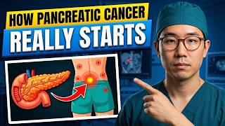 7 Symptoms of PANCREATIC CANCER That Will TERRIFY YOU — Critical Warning Signs