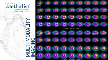 Stress Nuclear: Methodology and Case Studies (Faisal Nabi, MD) January 28, 2020