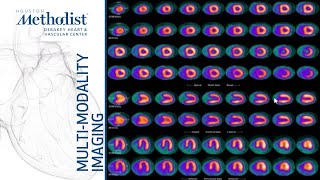 Stress Nuclear: Methodology and Case Studies (Faisal Nabi, MD) January 28, 2020