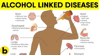 Alcohol Can Cause These 5 Serious Diseases