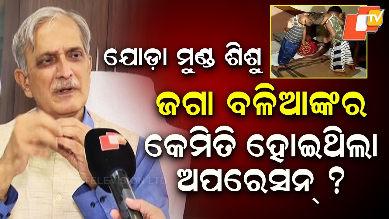 Dr. Ashok Mahapatra Reveals How Conjoined Child Jaga Balia’s Surgery Was Done
