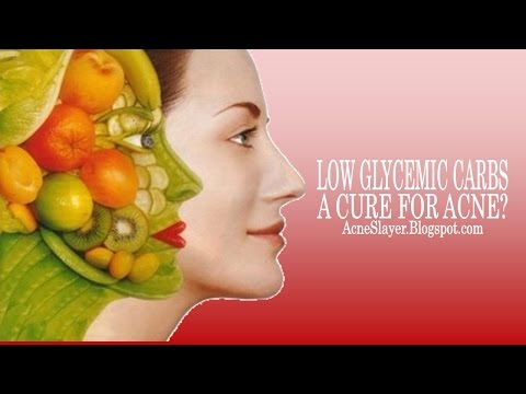 Low Glycemic Carbs: A cure for acne?