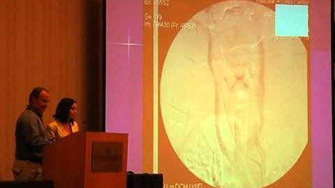 Dr. McGuckin lecture on interesting CCSVI case - Hubbard Foundation 2011 CCSVI Conference